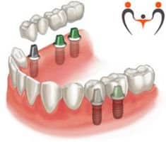 Slider image (1) Dental Dynasty